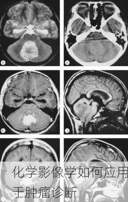 化学影像学如何应用于肿瘤诊断
