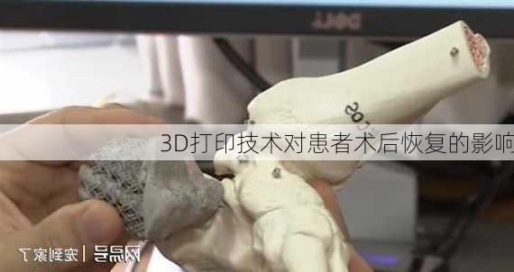 3D打印技术对患者术后恢复的影响