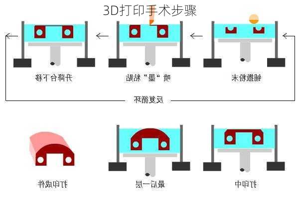 3D打印手术步骤