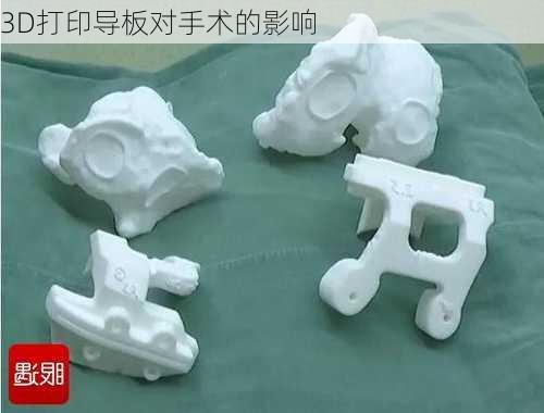 3D打印导板对手术的影响