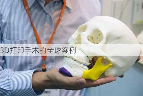 3D打印手术的全球案例