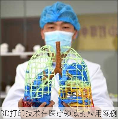 3D打印技术在医疗领域的应用案例